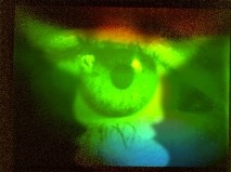 eye3